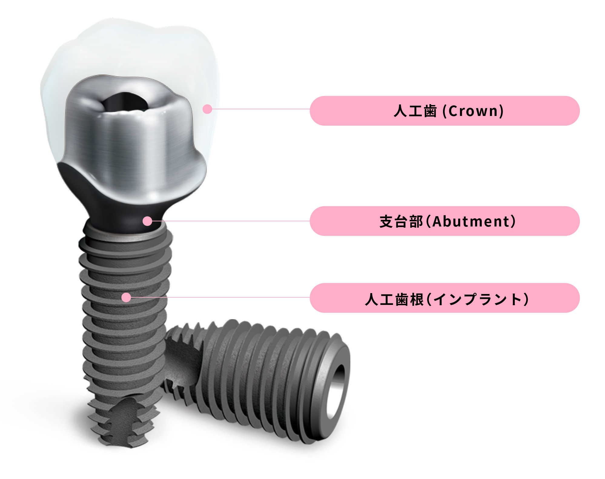 IMPLANT SYSTEM|DIOデジタル株式会社|インプラント・歯科医療用各種機器・材料の販売